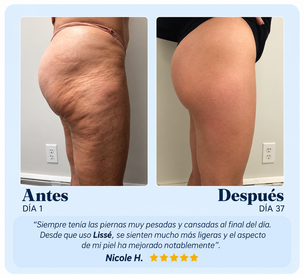 Lissé Contour™ — Piel más lisa y firme en 10 minutos al día